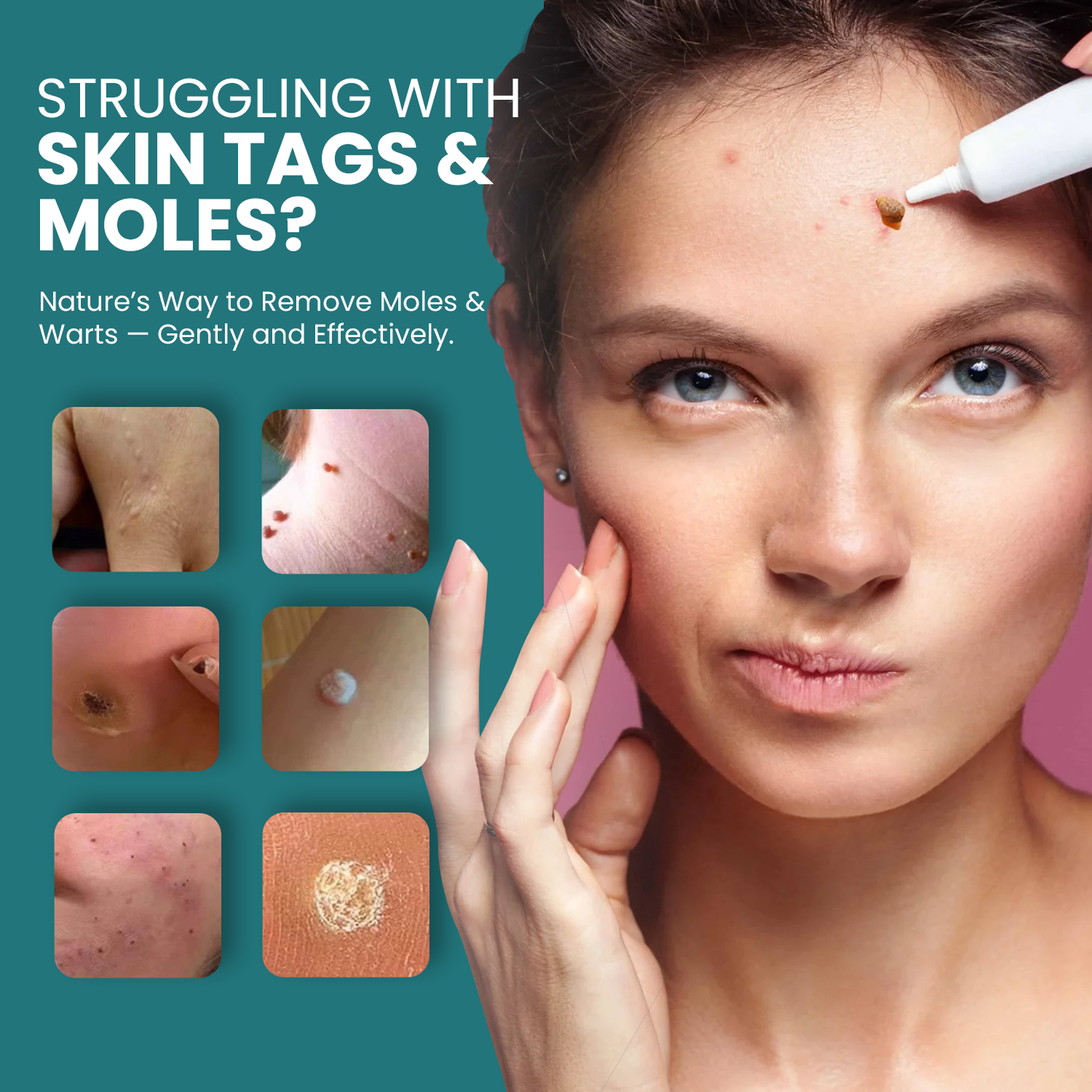 Fivfivgo® NatureStore Mole and Wart Removal Gel