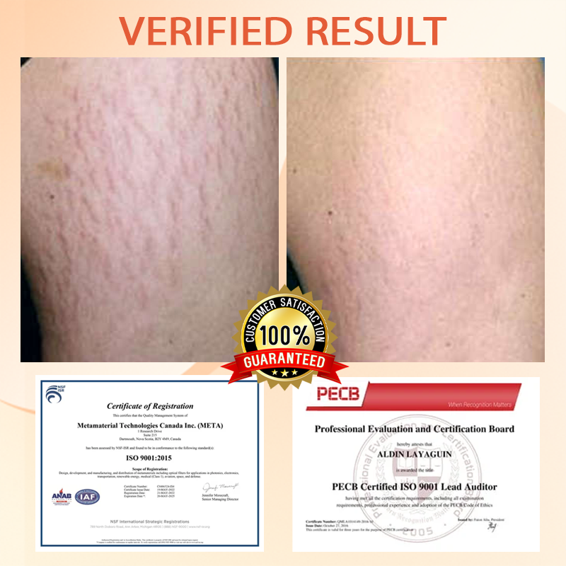 Fivfivgo™ Skin Firming and Scar Repair Oil