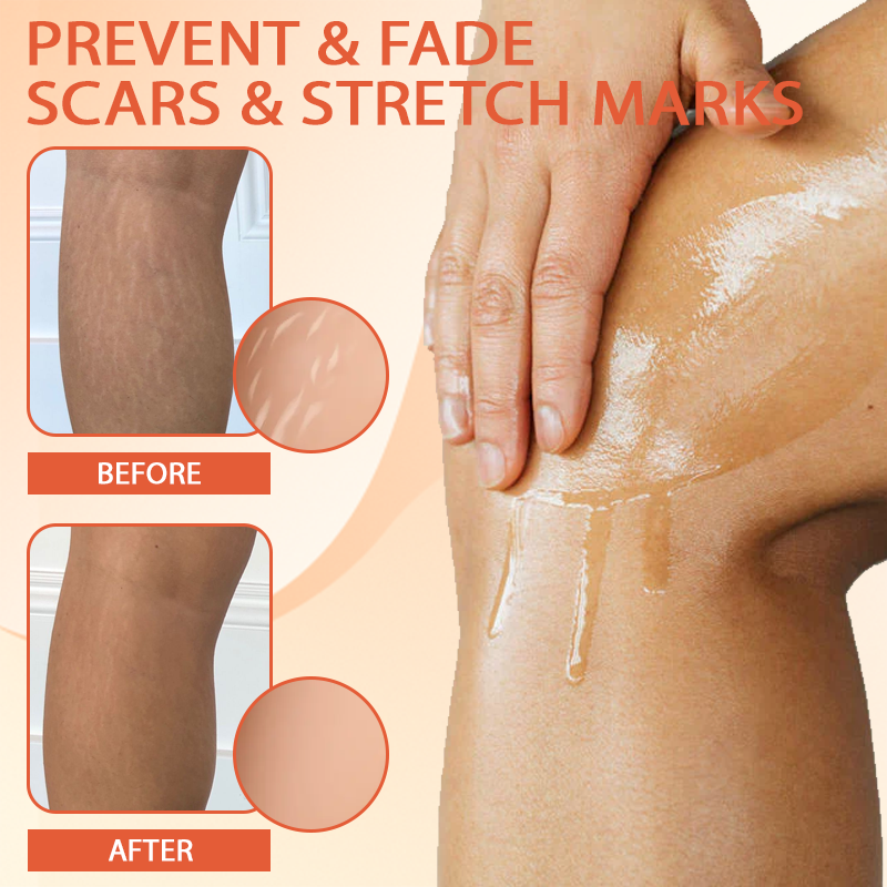 Fivfivgo™ Skin Firming and Scar Repair Oil