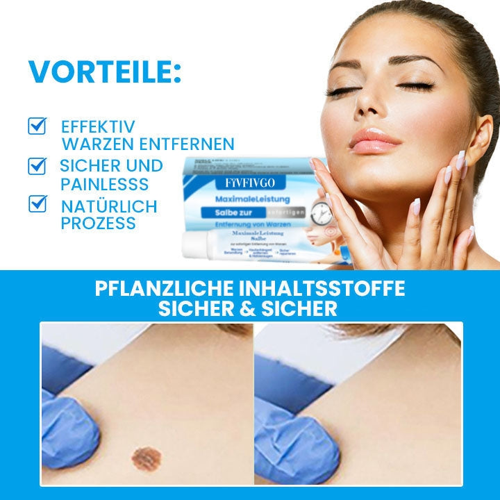 Fivfivgo™ MaximaleLeistung Salbe zur sofortigen Entfernung von Warzen