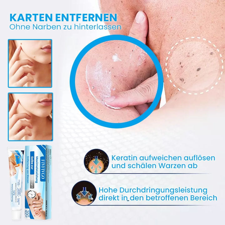 Fivfivgo™ MaximaleLeistung Salbe zur sofortigen Entfernung von Warzen