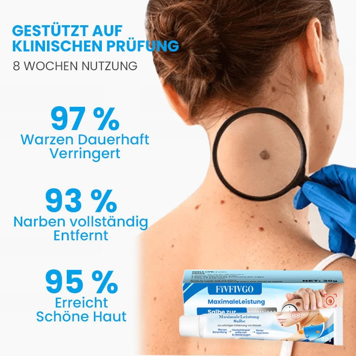 Fivfivgo™ MaximaleLeistung Salbe zur sofortigen Entfernung von Warzen