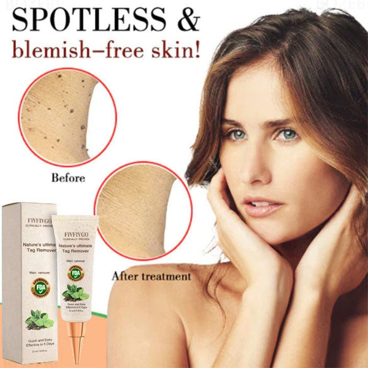 Fivfivgo™ Naturel Dissolvant d'étiquette de peau