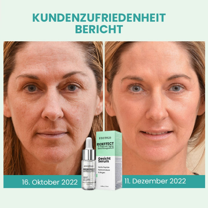 Fivfivgo™ RIOEFFECT 30 Tage Anti-Aging Behandlungsserum