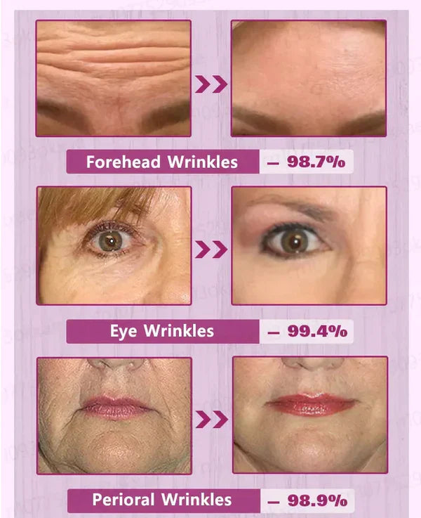 Fivfivgo™ Botox Facial Serum