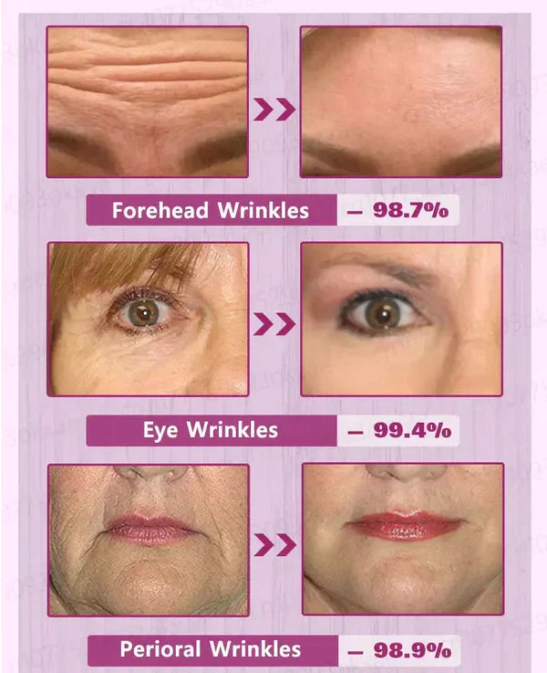 Fivfivgo™ Botox-Gesichtsserum