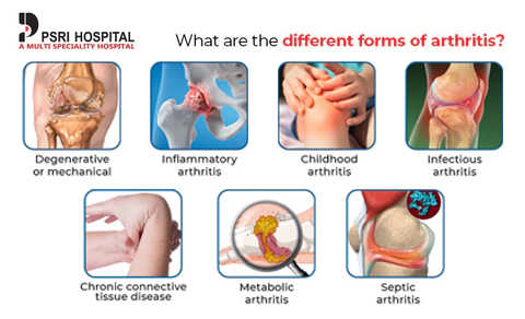 Fivfivgo™ Bee Venom Advanced Joint and Bone Therapy Cream (New Zealand Bee Extract - Specializes in Orthopedic Diseases and Arthritis Pain)
