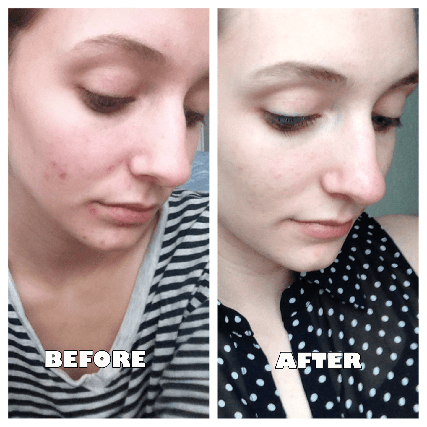 PerfectPore™ Detoxifying Water-injecting Mask