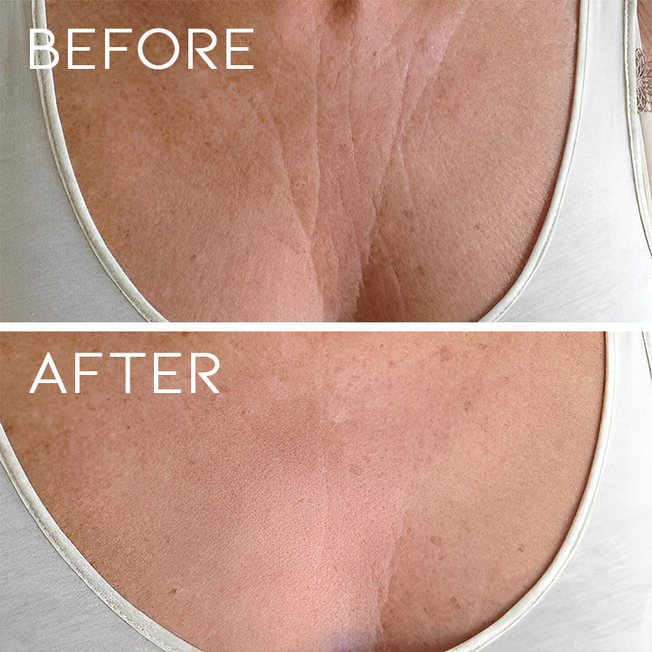 Anti-sagging Silicone Chest Patch Personal Care Every Day And Night 