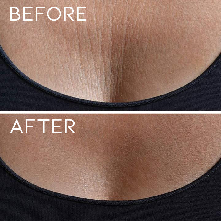 Anti-sagging Silicone Chest Patch Personal Care Every Day And Night 