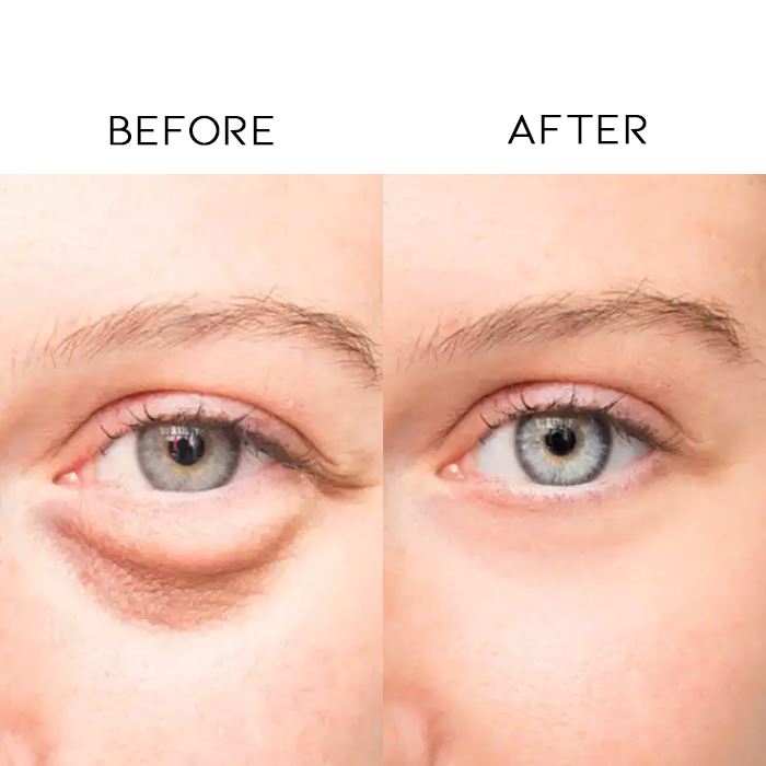 Caffeine Tightening Eye Cream Skin Care Every Day And Night 