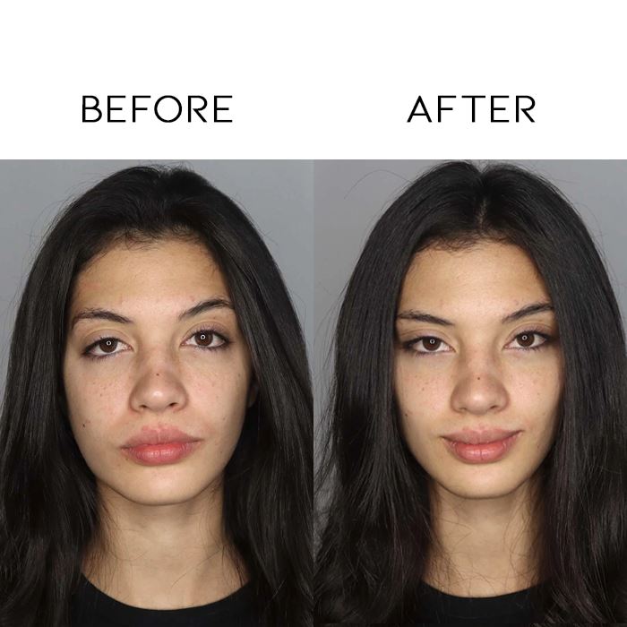 V-Lift Invisible Face Lifting Tape Every Day And Night 