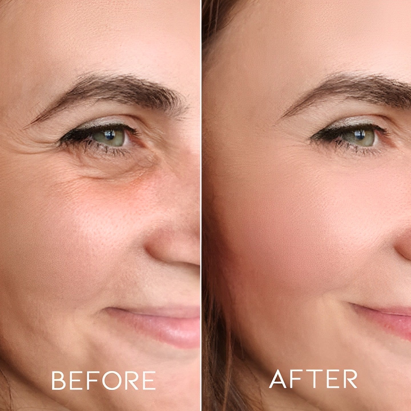 Micro-darts Anti-Wrinkle Patches Personal Care Every Day And Night 