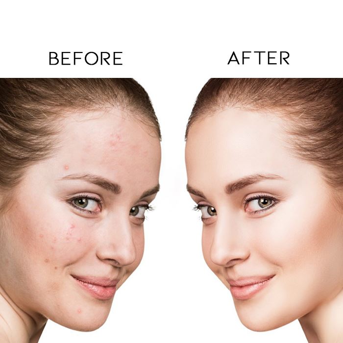 Vitamin C Dark Spots Removal Night Cream Skin Care Every Day And Night 