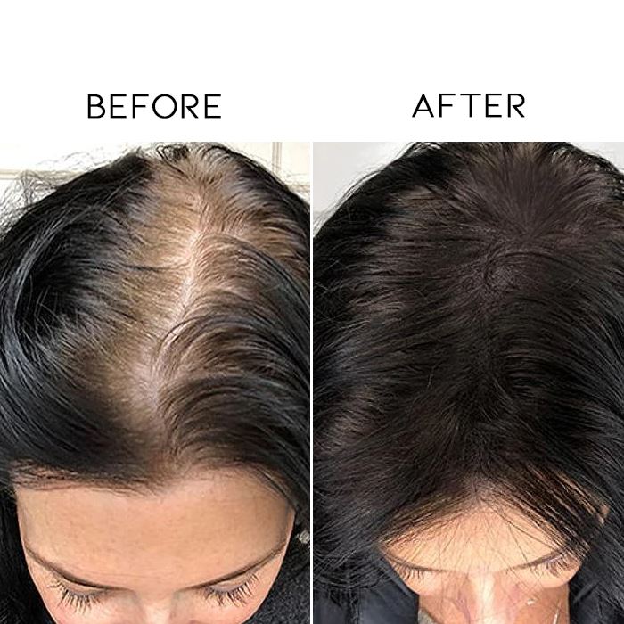 Roll On Strengthen Hair Serum Hair Care Every Day And Night 