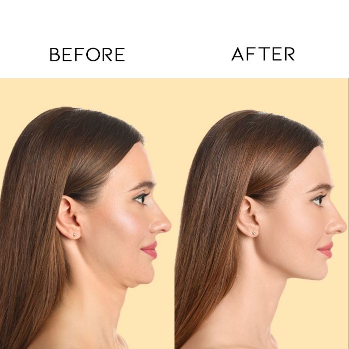 YouthRefine Serum Infused Neck Mask Skin Care Tools Every Day And Night 