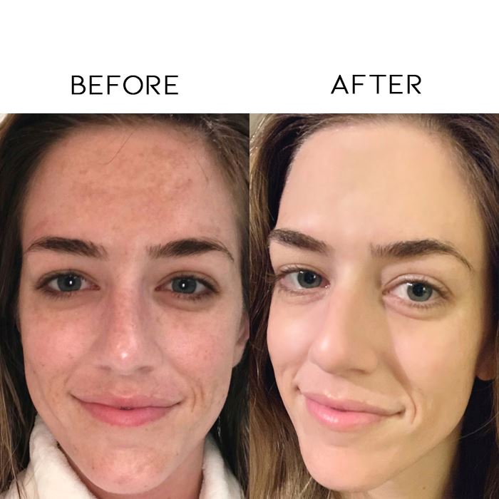 Lazy Skincare Rinse-Free Gel Mask (4pcs Set) Skin Care Every Day And Night 