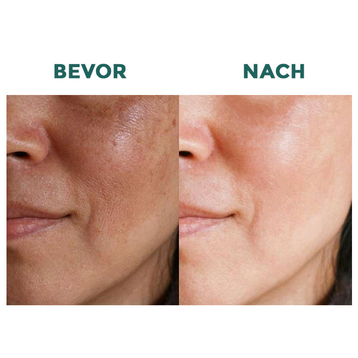 Fivfivgo™ Kollagen-Milch Whitening Seife