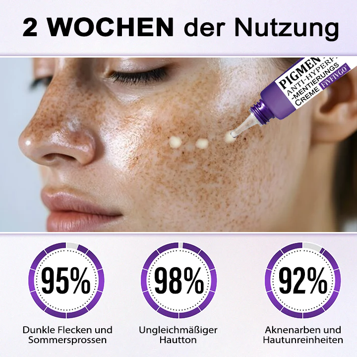 Fivfivgo® PigmentaX ProFade Anti-Hyperpigmentierungs Creme