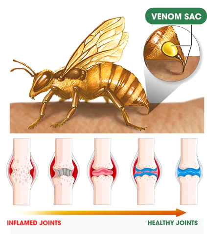 Fivfivgo™ Bee Venom Advanced Joint and Bone Therapy Cream (New Zealand Bee Extract - Specializes in Orthopedic Diseases and Arthritis Pain)