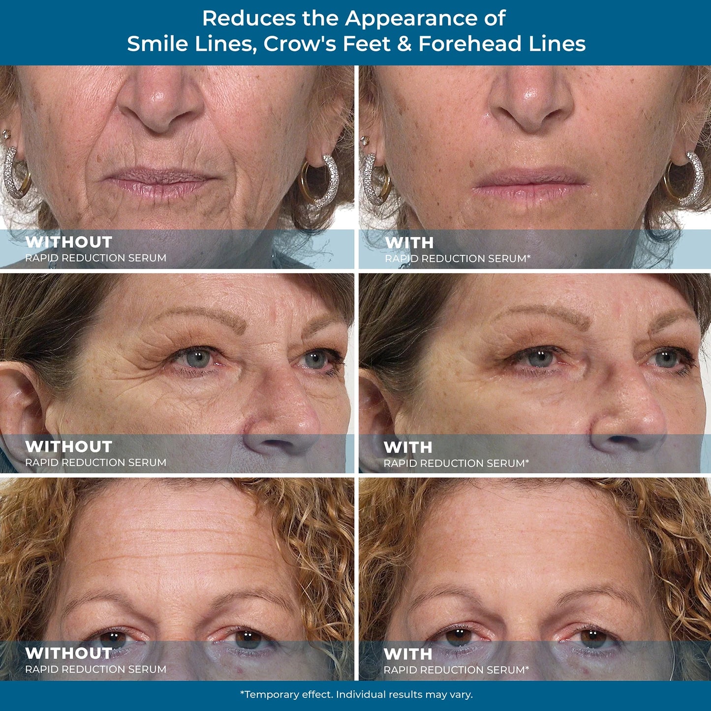 Fivfivgo™ Schnell Reduktion Serum