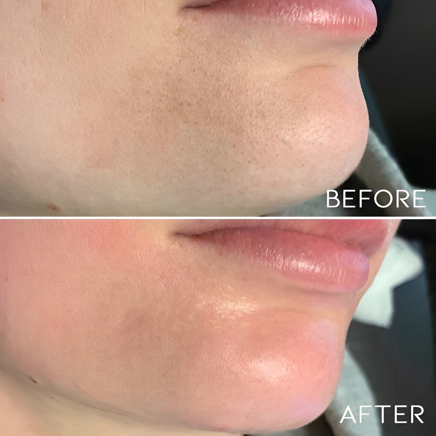 Deep Cleaning Gold Peel-Off Mask Personal Care Every Day And Night 
