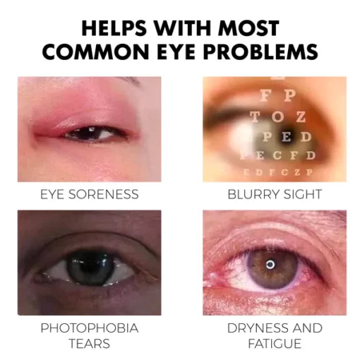 Fivfivgo™ Treatment Eye Problems Solution Drops
