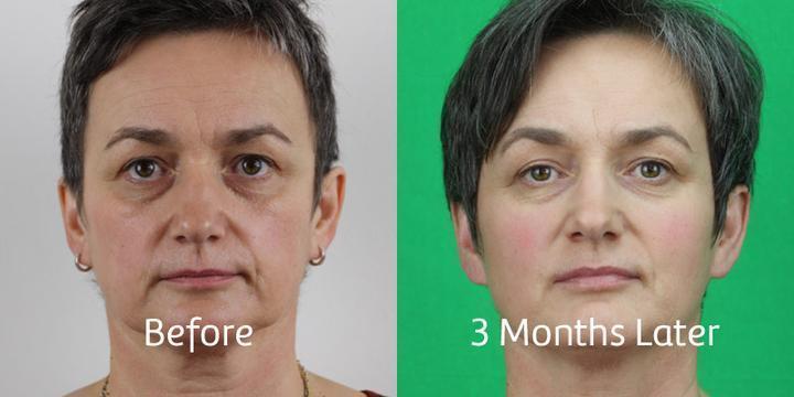 Nutrispot™ Neck Lymphatic Detox Patch (Set of 10)