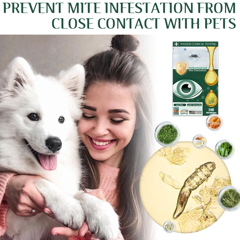 Fivfivgo™ Lingettes Anti-Acariens Terpinéol d'Arbre à Thé