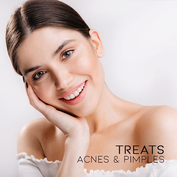 Tea Tree Ance Treatment Cream Skin Care Every Day And Night 