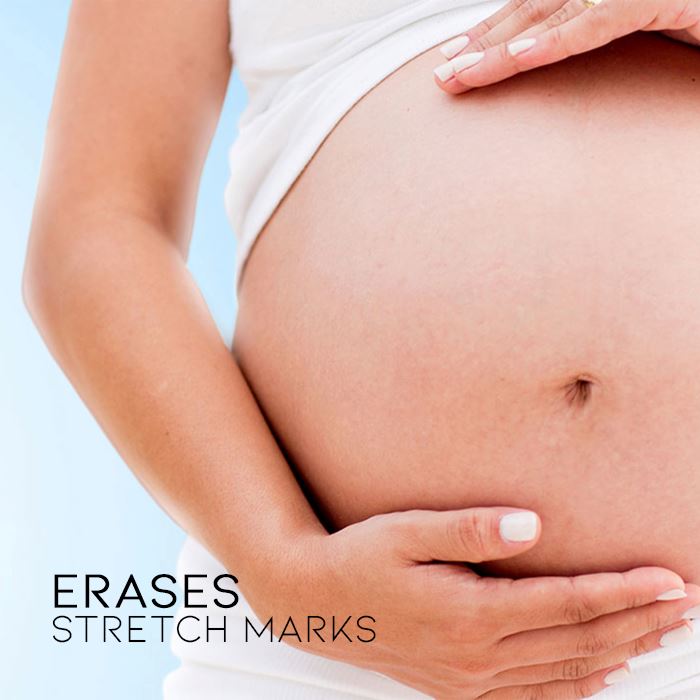 Scar & Stretch Marks Treatment Skin Care Every Day And Night 