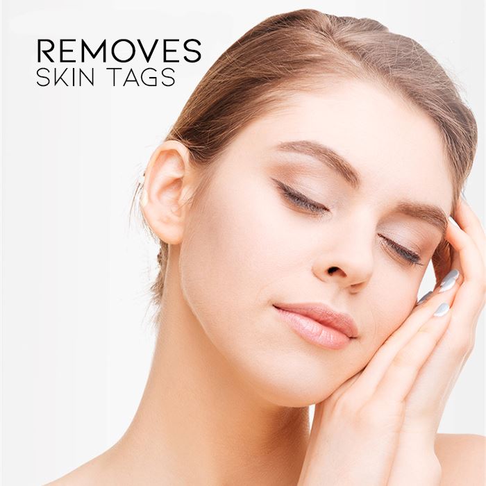 Skin Tag Removal Tool Skin Care Tools Every Day And Night 