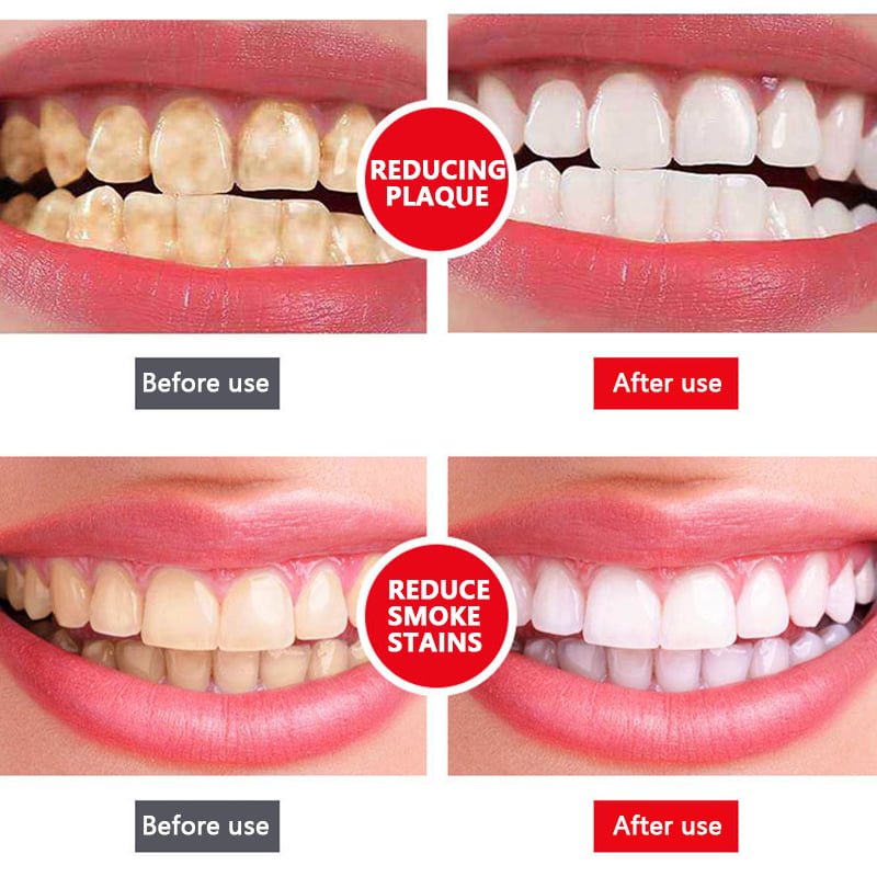 Fivfivgo™ 4TM Dentifricio sbiancante probiotico