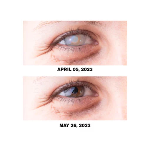 Fivfivgo™ Traitement Problèmes oculaires Solution Gouttes
