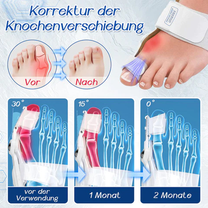 Fivfivgo™ Hallux-Valgus-Korrekturhilfe
