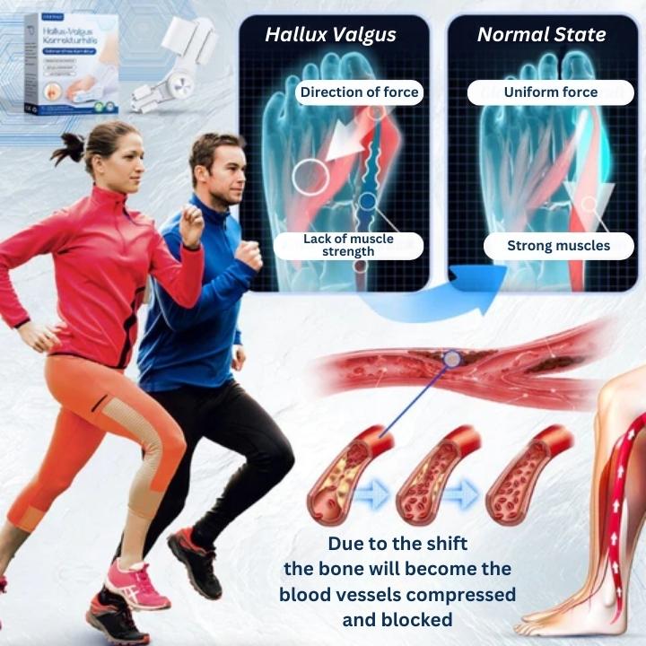 Fivfivgo™ Hallux-Valgus Correction Aid