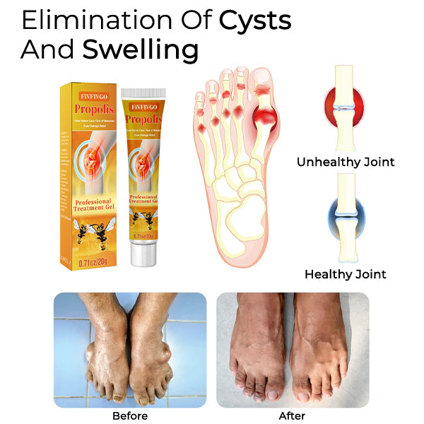 Fivfivgo™ Gel de traitement des articulations et des os à base de venin d'abeille