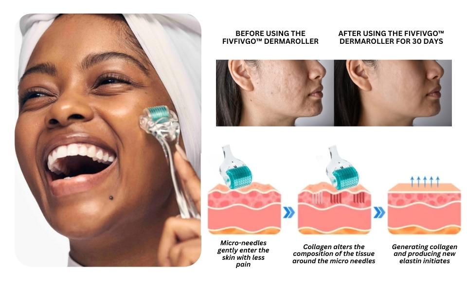 Fivfivgo™ Dermaroller collagène 0,5 mm Dr. Treat PockmarksHeal
