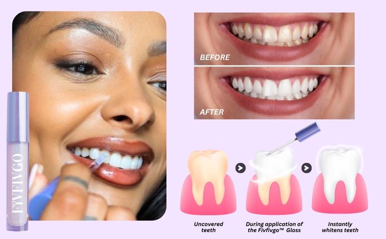 Fivfivgo™ Brillant à Dents Brillant