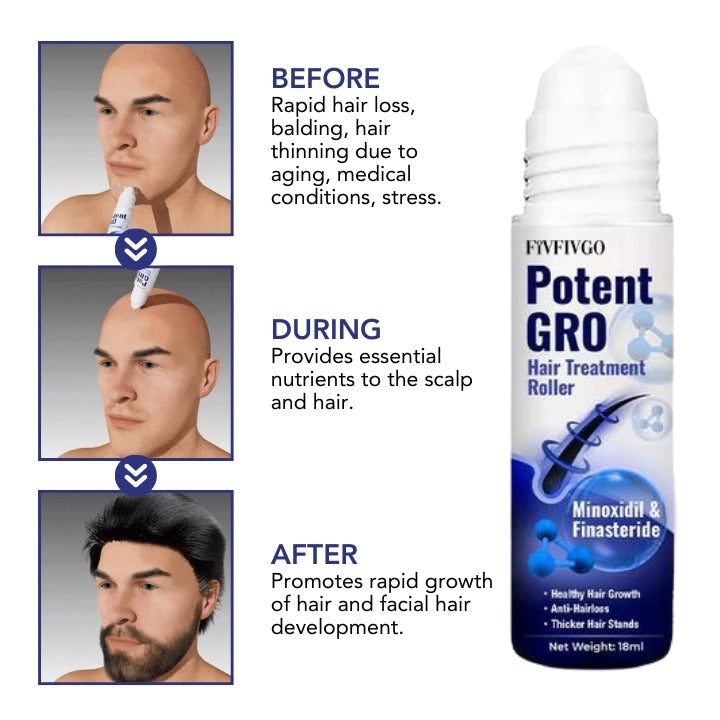 Fivfivgo™ PotentGRO Rouleau de traitement des cheveux