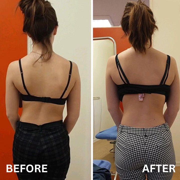 Fivfivgo™ Dispositif Portatif de Mise en Forme du Cou pour le Corps de la Scoliose