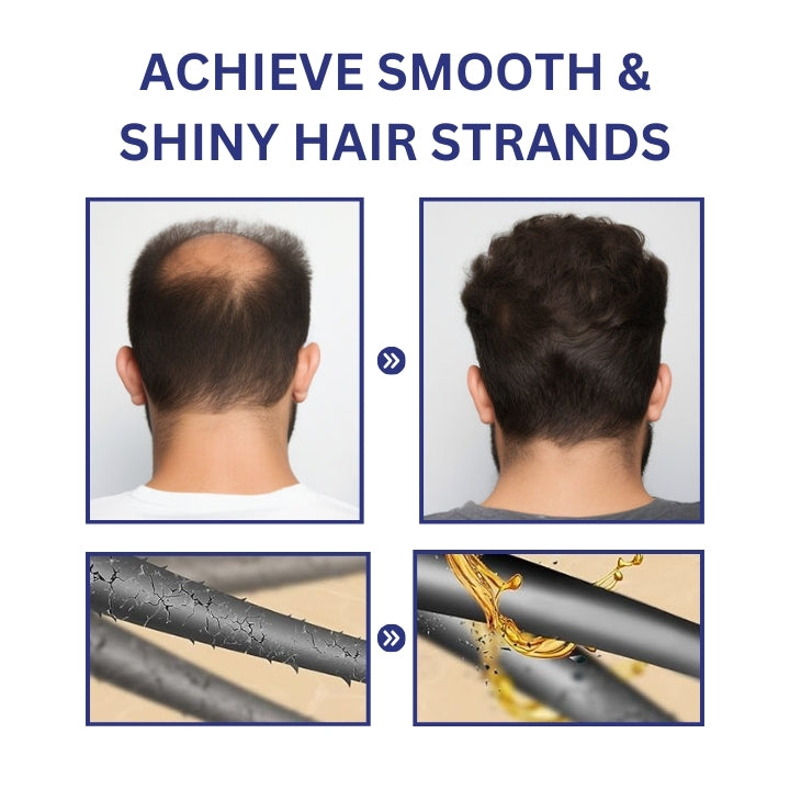 Fivfivgo™ PotentGRO Hair Treatment Roller