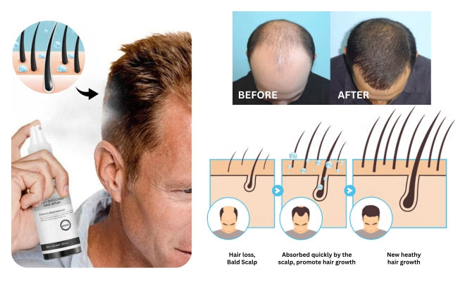 Fivfivgo™ Anti-Haarausfall-Spray