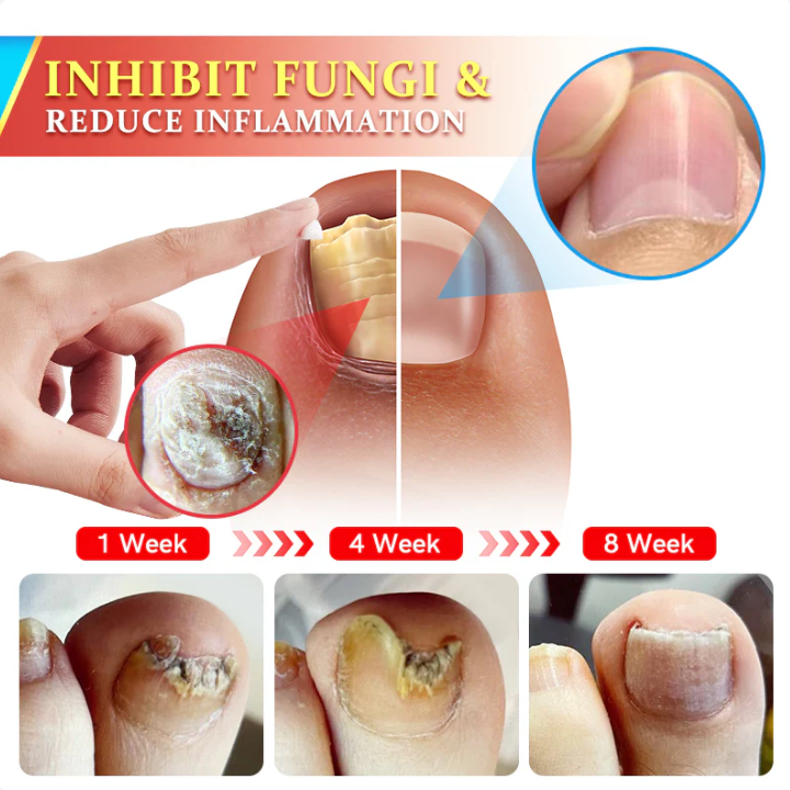 Fivfivgo™ Psoriasis Antibacterial Treatment Cream