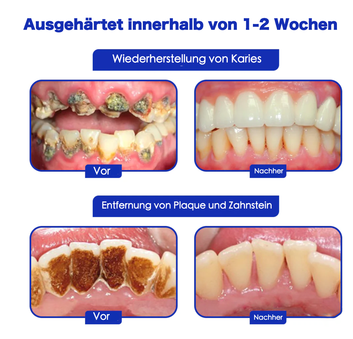 Fivfivgo™ IntelligeSmile Zahnpasta mit Bienengift