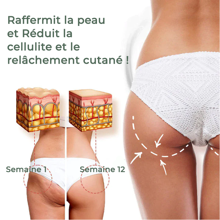 Fivfivgo™ Wormwood CelluliteBeGone Crème raffermissante pour la peau