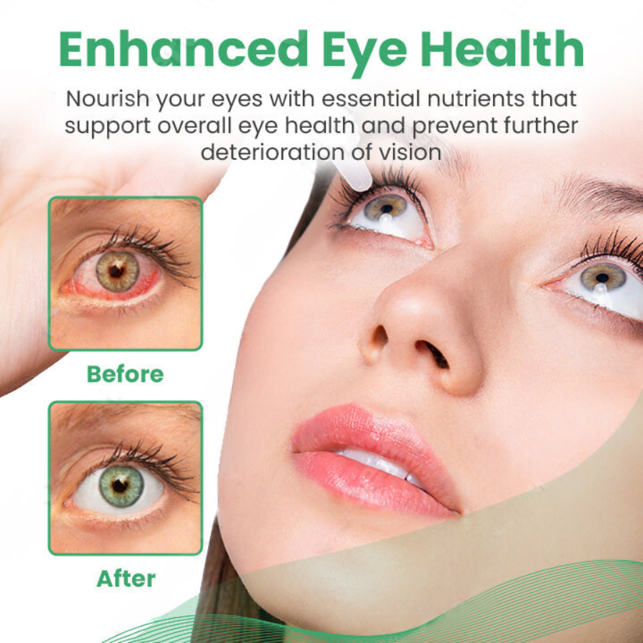 Fivfivgo™ EYEase Myopia Cure Drops
