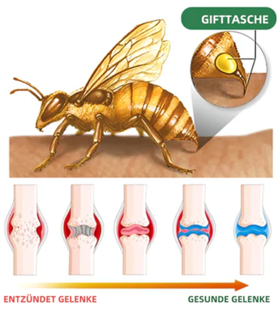 Fivfivgo™ Bienengift Fortgeschrittenes Gelenkt und Knochentherapie-Creme (Neuseeländischer Bienenextrakt - Spezialisiert auf orthopädische Erkrankungen und Arthritisschmerzen)