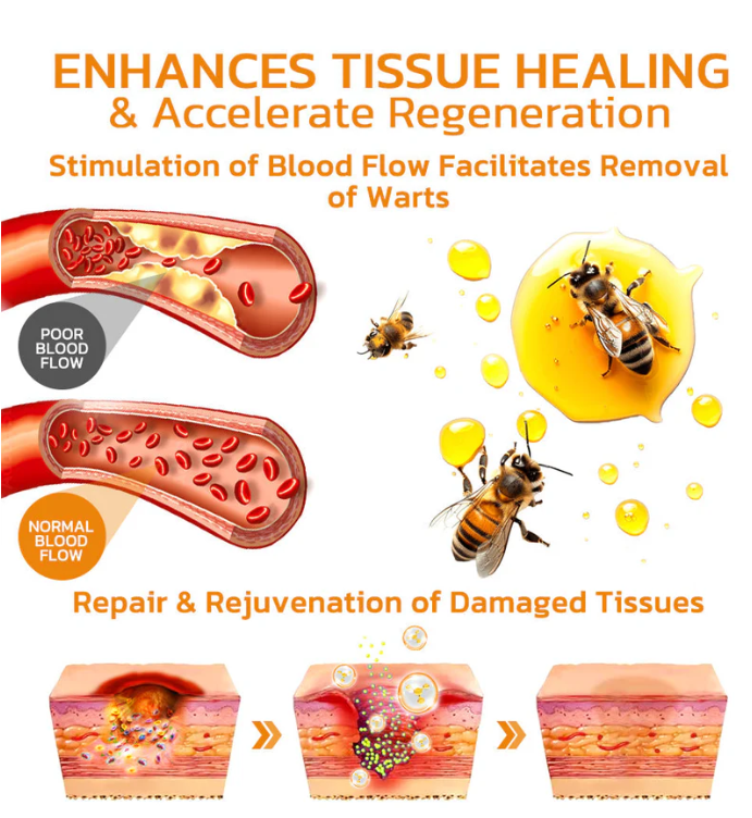 Fivfivgo™ Bee Venom Warts & Blemish Remover