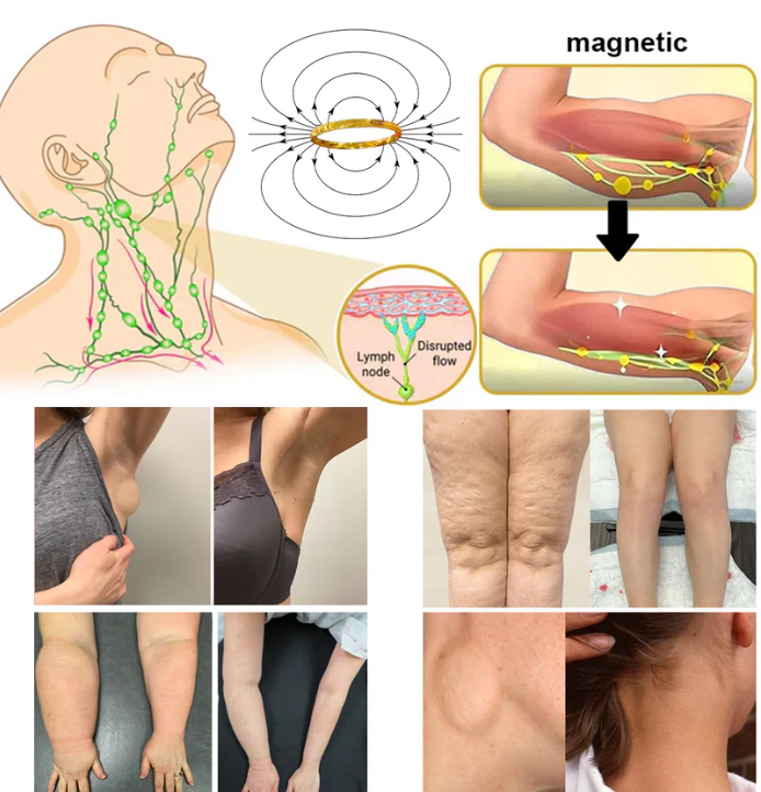 Lymphatic Magnetic Therapy Cat’s Eye Ring